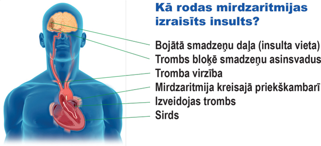 mirdzmija_full